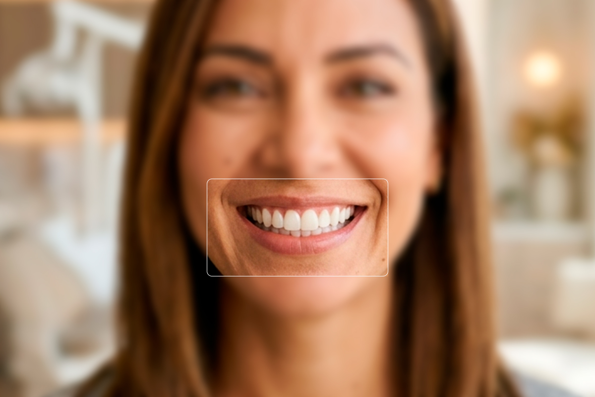 implantes dentales