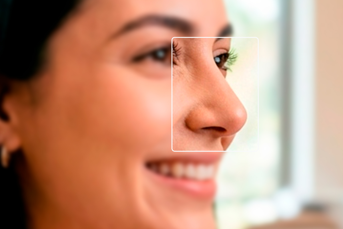 Rinoplastia